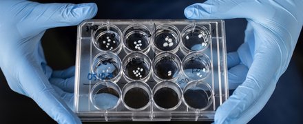 Brain organoids held in a dish by two hands wearing blue laboratory gloves